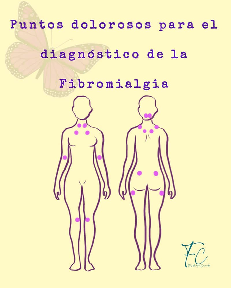 Tratamiento de la Fibromialgia en Alcalá de Henares
