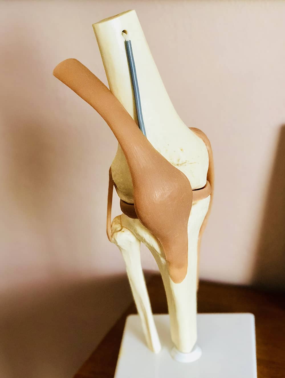fisioterapia para la tendinitis